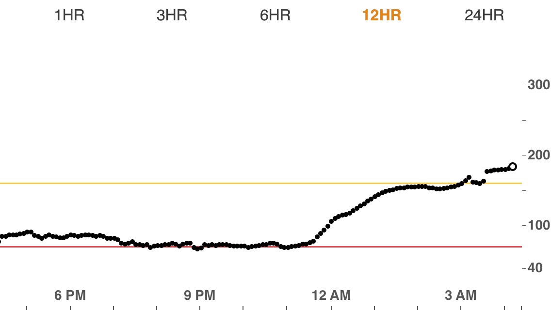 Blood sugar effects of cortisone shots Diabetes Stories