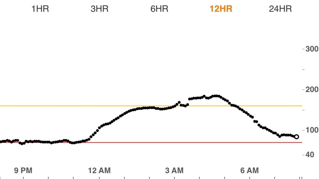 Blood sugar effects of cortisone shots Diabetes Stories